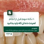 ۱۰ نکته مهم قبل از انجام لمینت دندان که باید بدانید