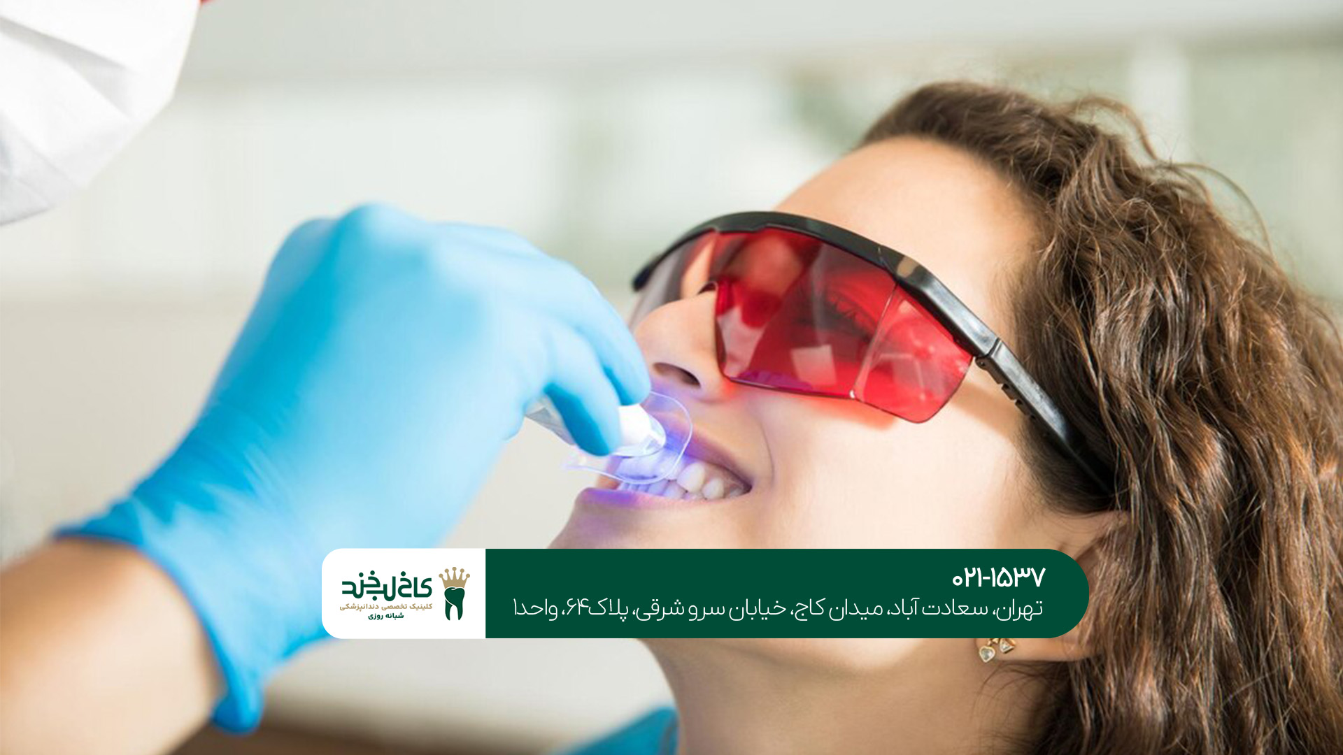 هزینه لمینت دندان در سال ۱۴۰۳ چه میزان است؟!