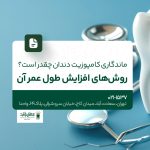 ماندگاری کامپوزیت دندان چقدر است؟! روش‌های افزایش طول عمر آن