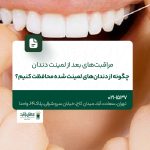 مراقبت‌های بعد از لمینت دندان؛ چگونه از دندان‌های لمینت شده محافظت کنیم؟!