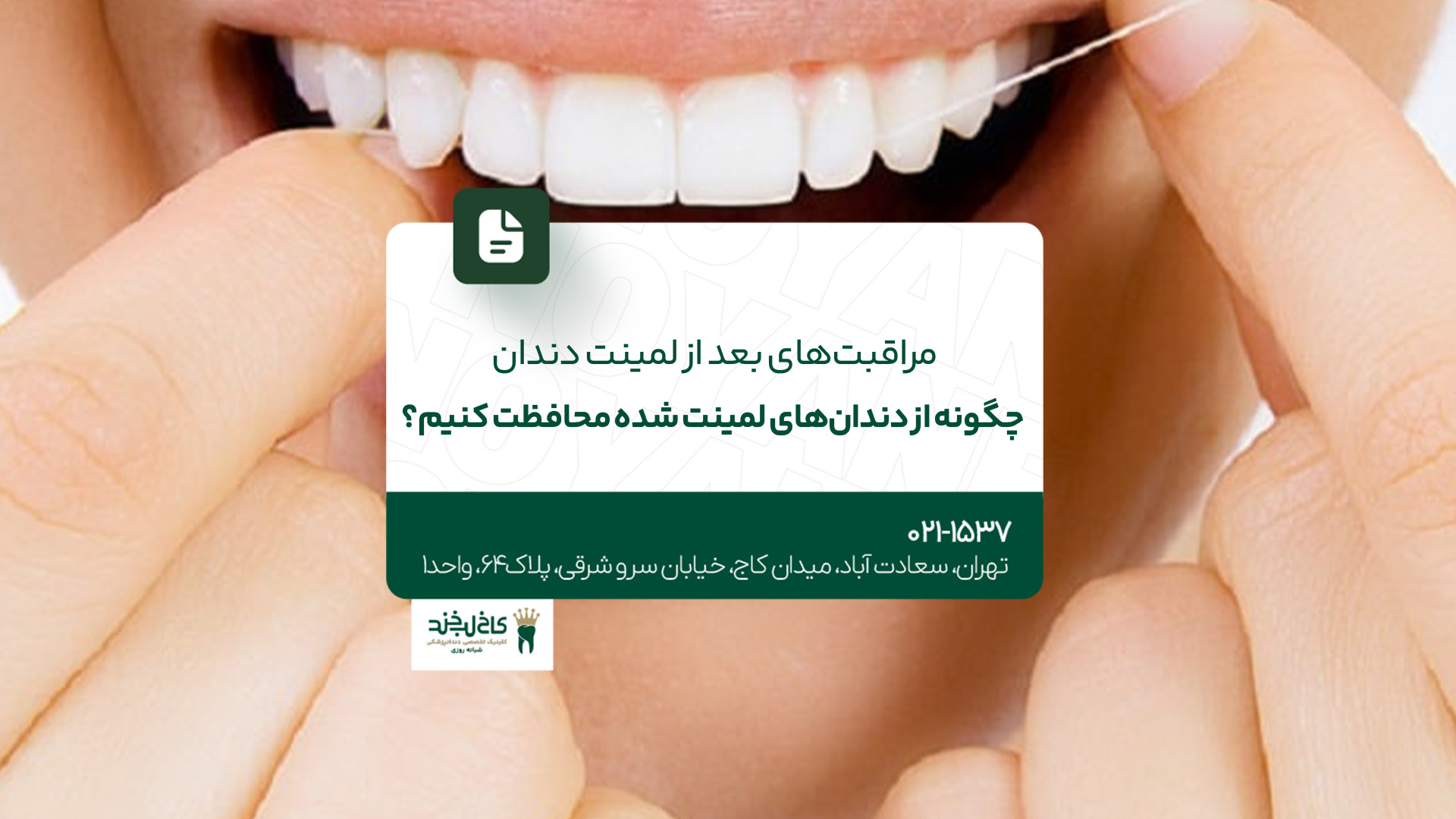 مراقبت‌های بعد از لمینت دندان؛ چگونه از دندان‌های لمینت شده محافظت کنیم؟!
