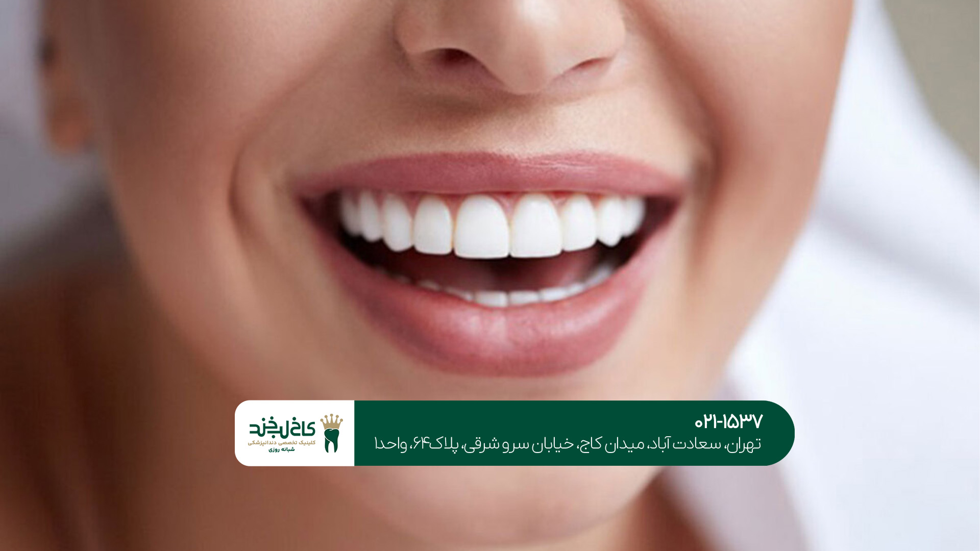 آیا نخ دندان برای لمینت دندان ضرر دارد؟!