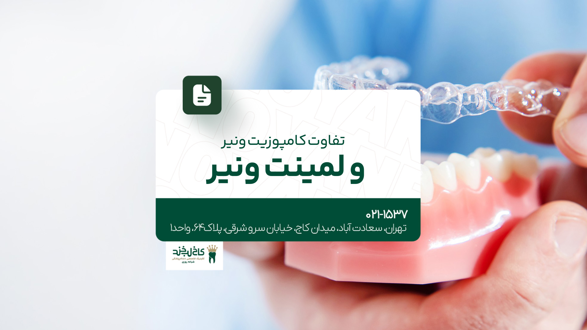 تفاوت کامپوزیت ونیر و لمینت ونیر
