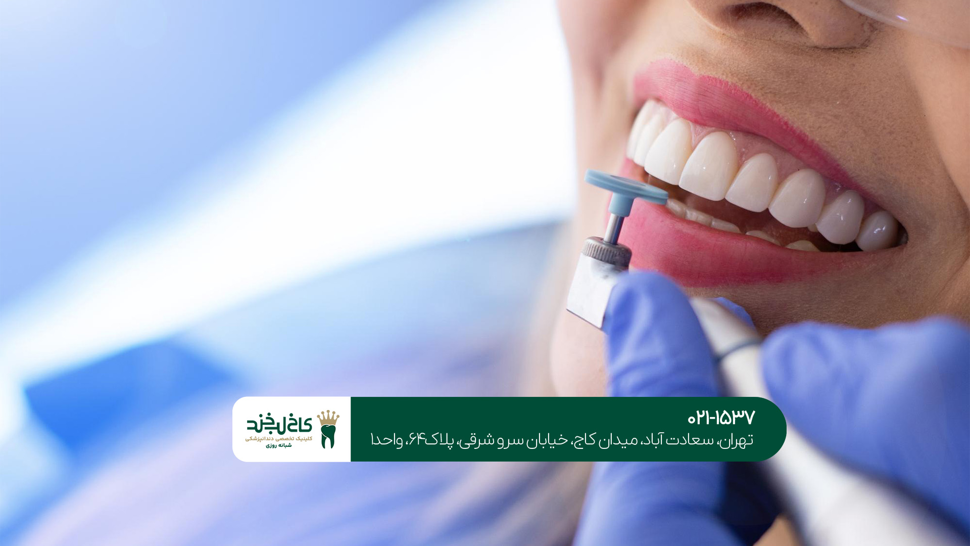 مقایسه هزینه کامپوزیت ونیر و لمینت ونیر: کدام مقرون به صرفه تر است؟!