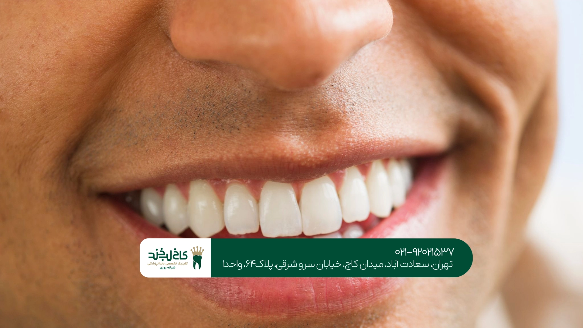 خدمات زیبایی دندان تهران خدمات زیبایی دندان تهران