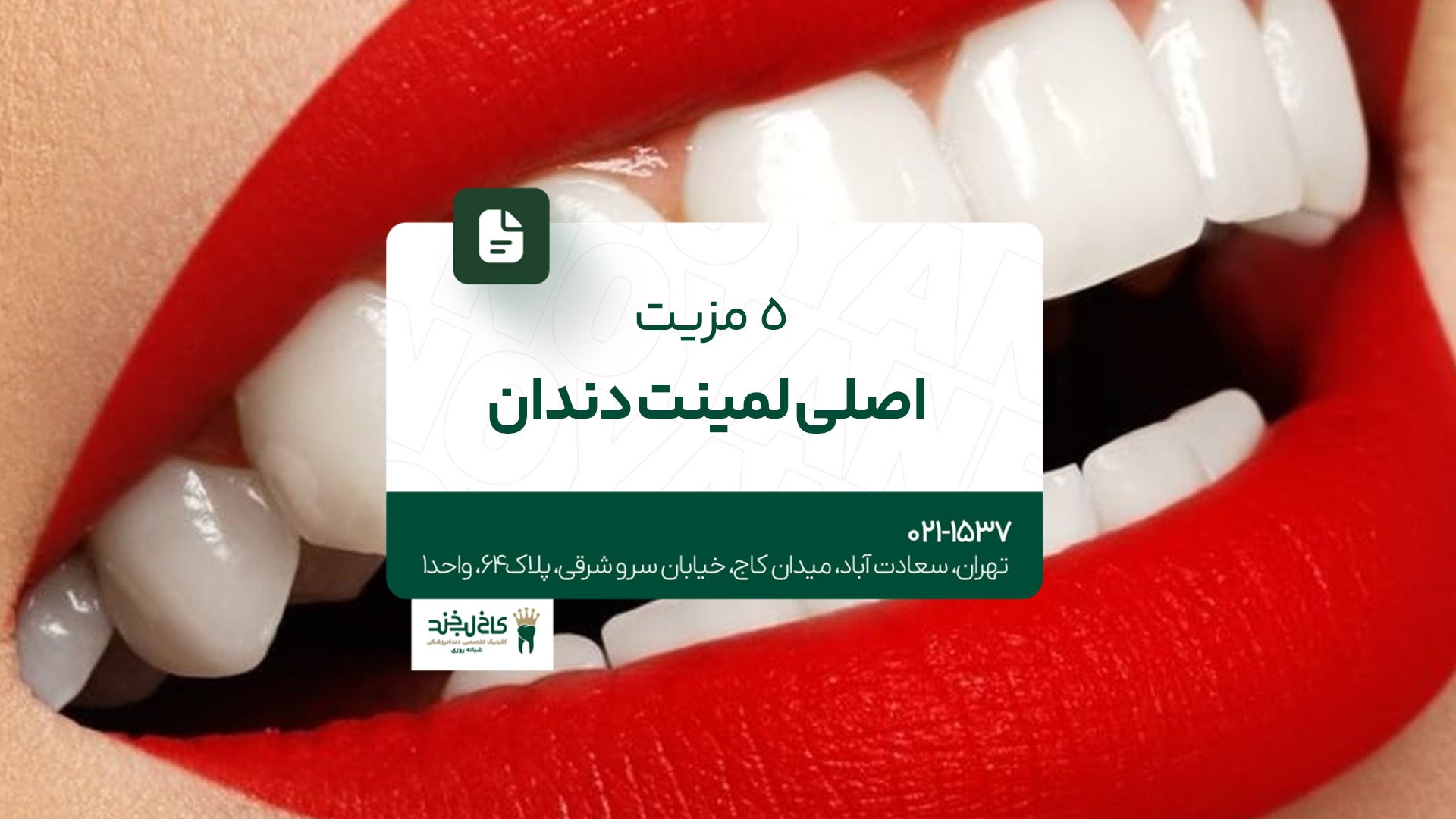 5 مزیت اصلی لمینت دندان