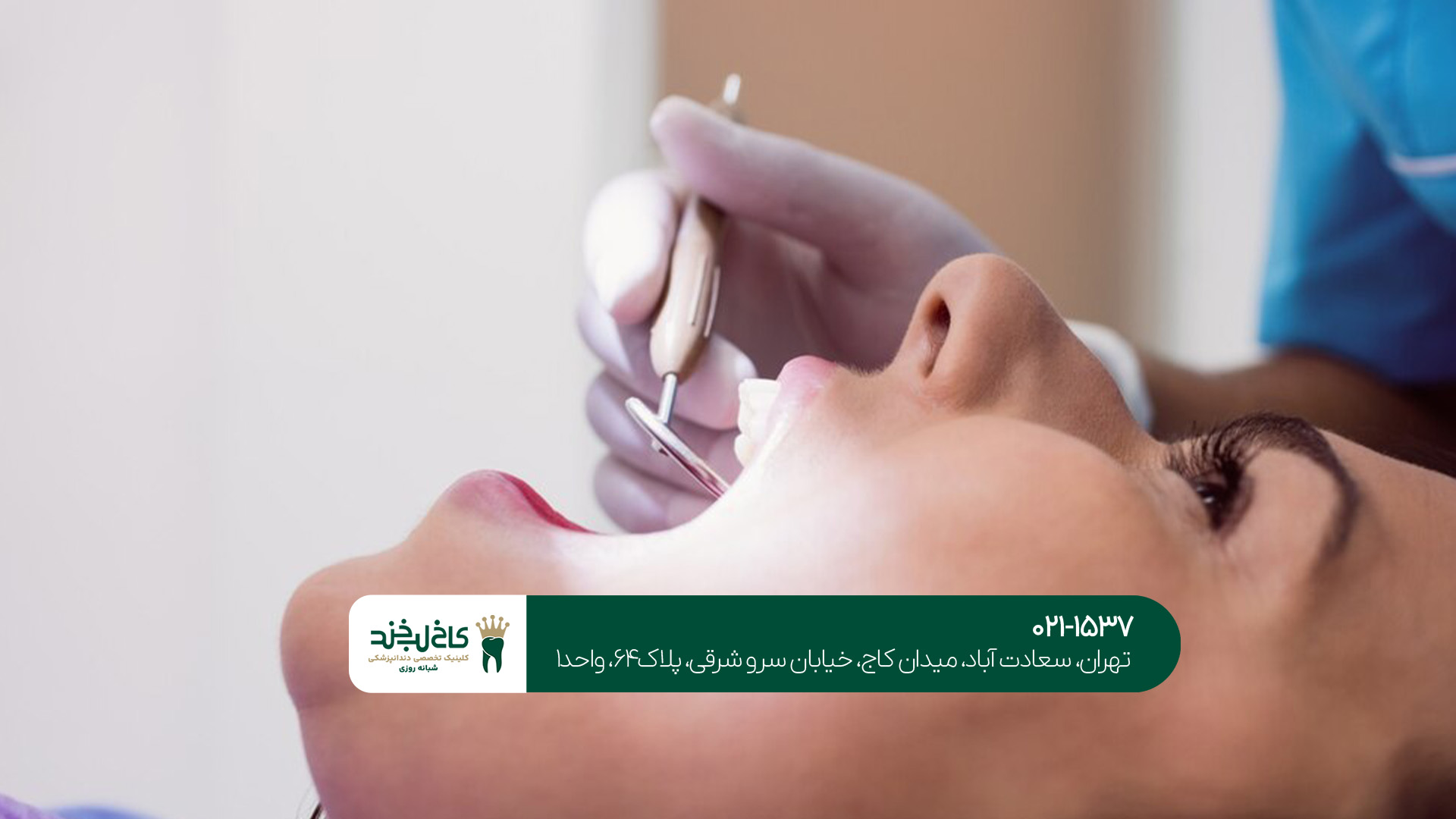 جرم ‌گیری دندان در تهران چگونه است؟