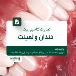 تفاوت کامپوزیت دندان و لمینت