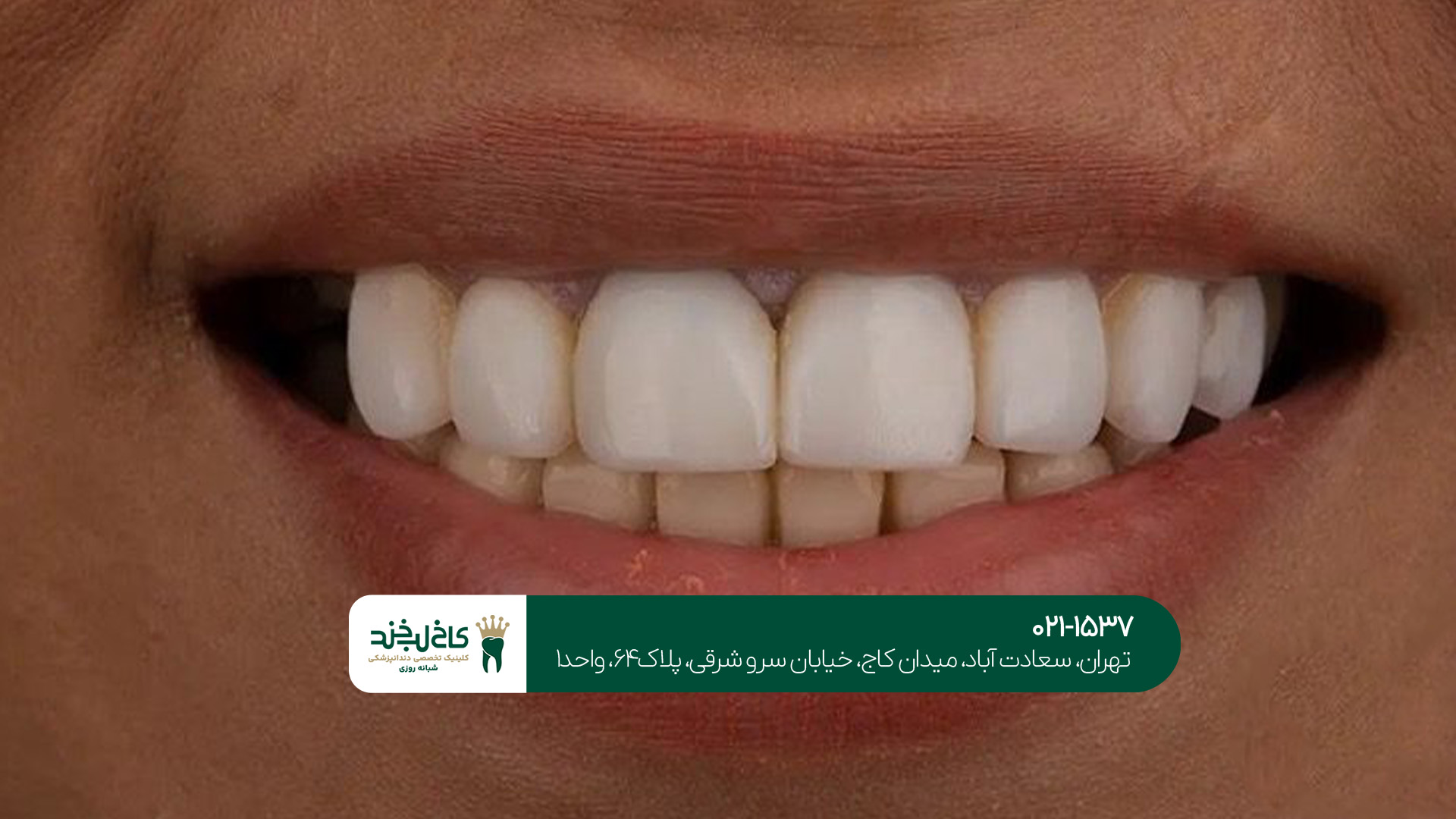 کاربردهای هر یک از این دو عمل