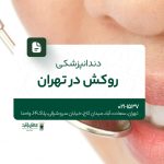 دندانپزشکی روکش در تهران