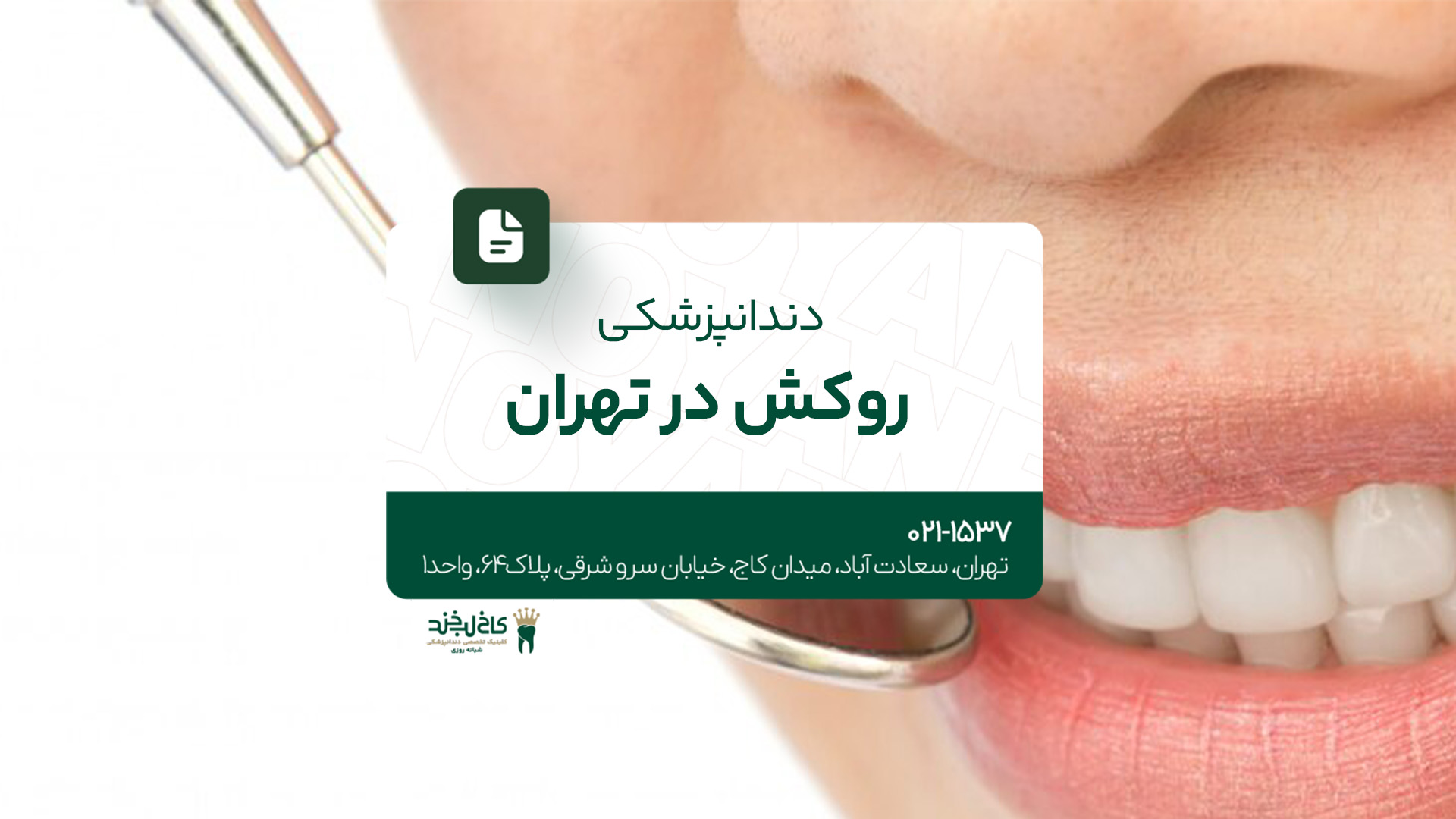 دندانپزشکی روکش در تهران