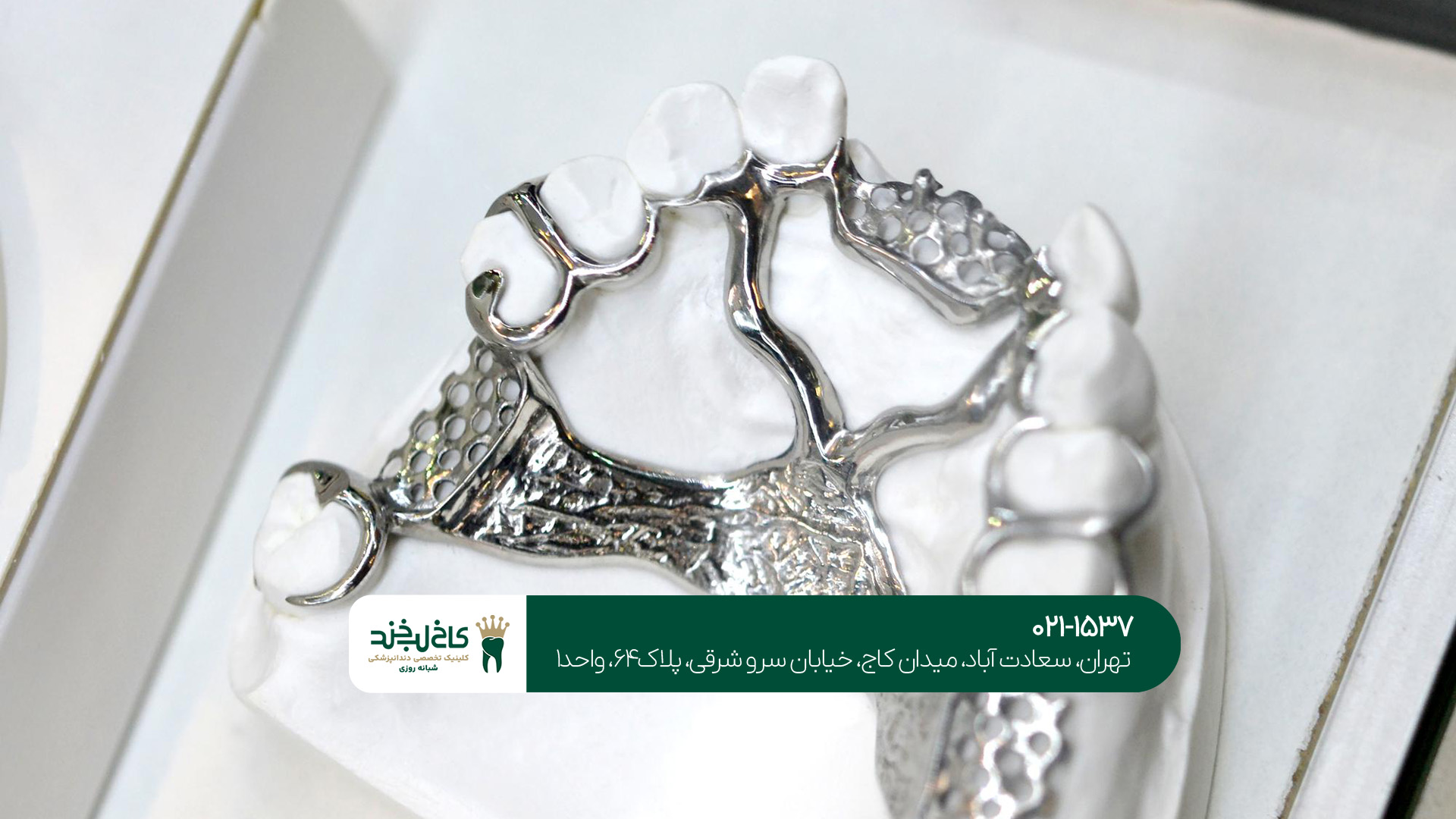 عوارض استفاده نکردن از بهترین برند ایمپلنت چیست؟!