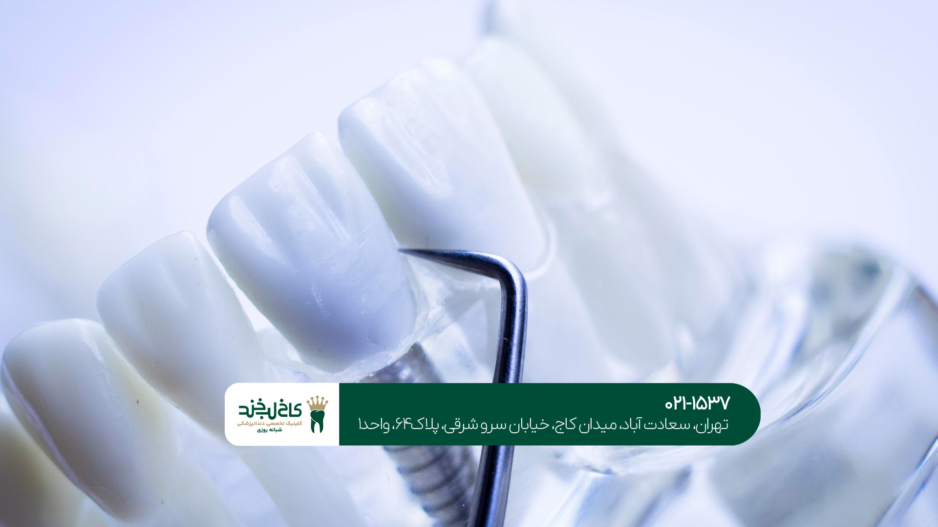 ایمپلنت دندان چه انواعی دارد؟!