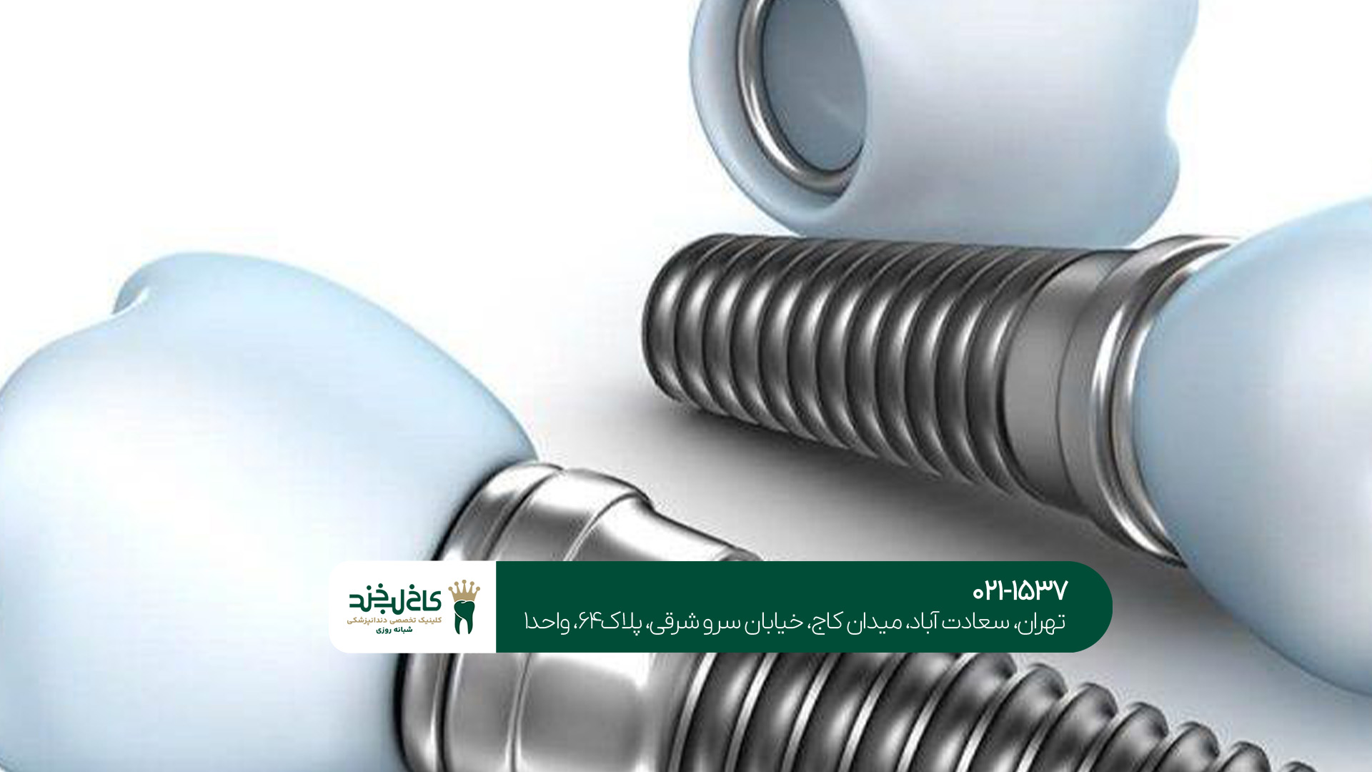 ایمپلنت سوئیسی اشترومن (ITI)