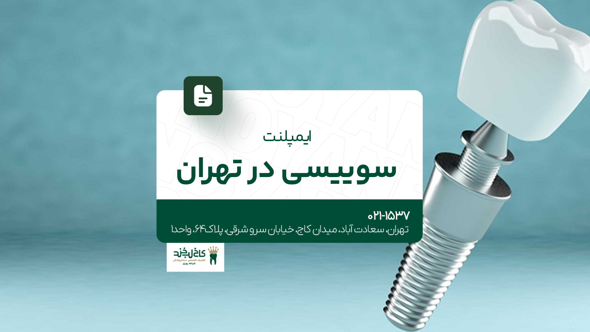 ایمپلنت سوئیسی در تهران 
