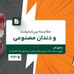 مقایسه بین ایمپلنت و دندان مصنوعی