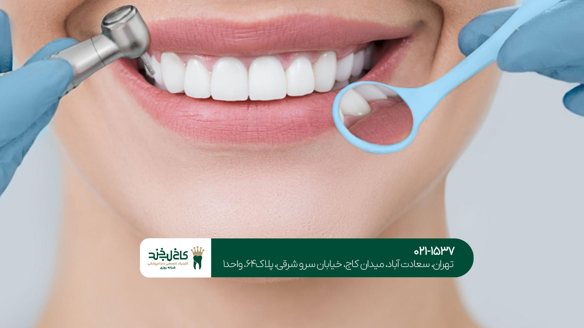 دریافت نوبت آنلاین از دندانپزشکی خدمات زیبایی دندان در تهرانسر 