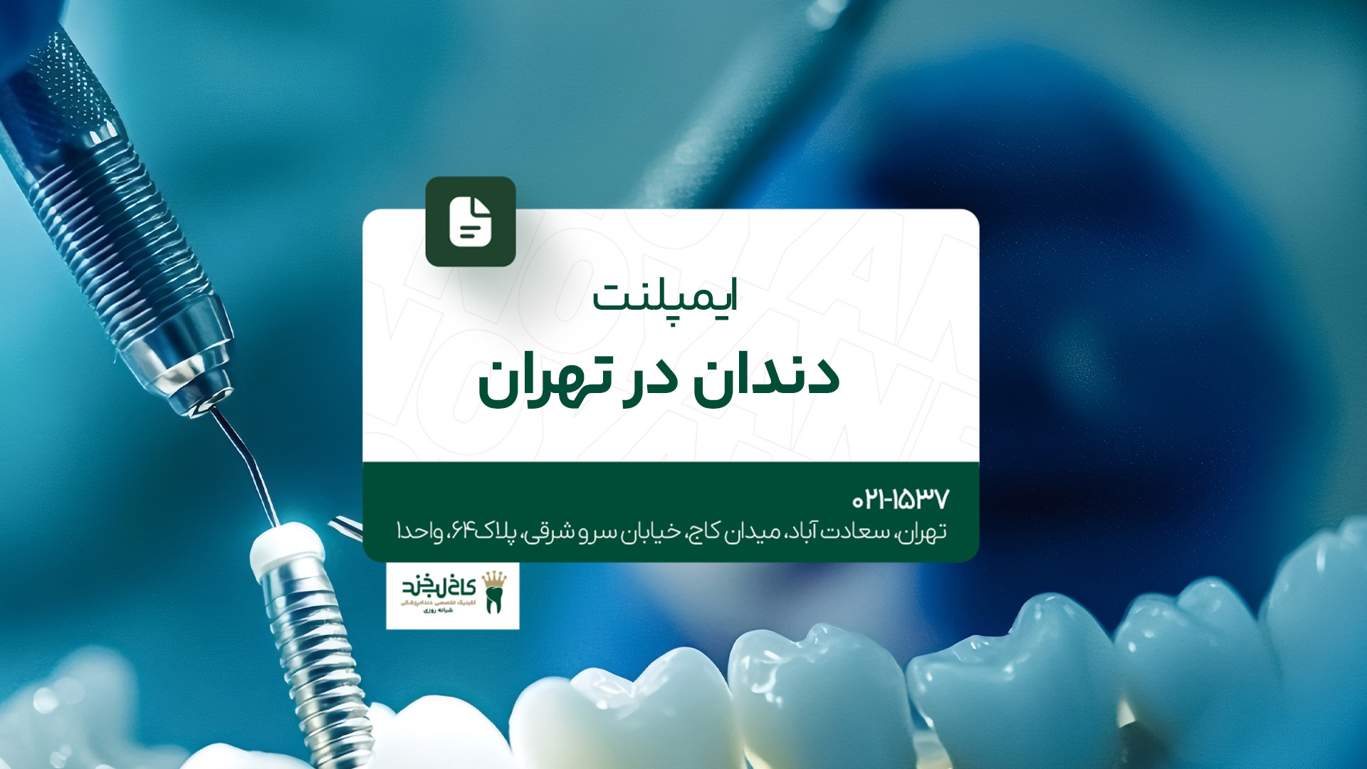 ایمپلنت دندان در تهران