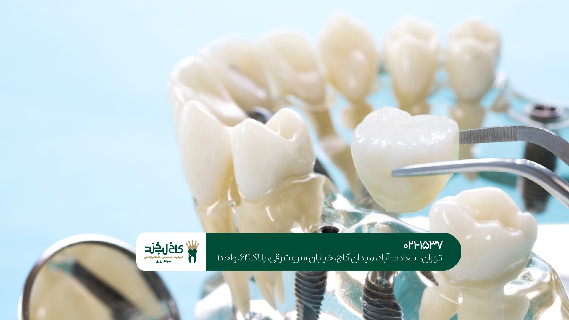 چه کسانی نمی‌توانند ایمپلنت یک روزه دندان را نصب کنند؟!
