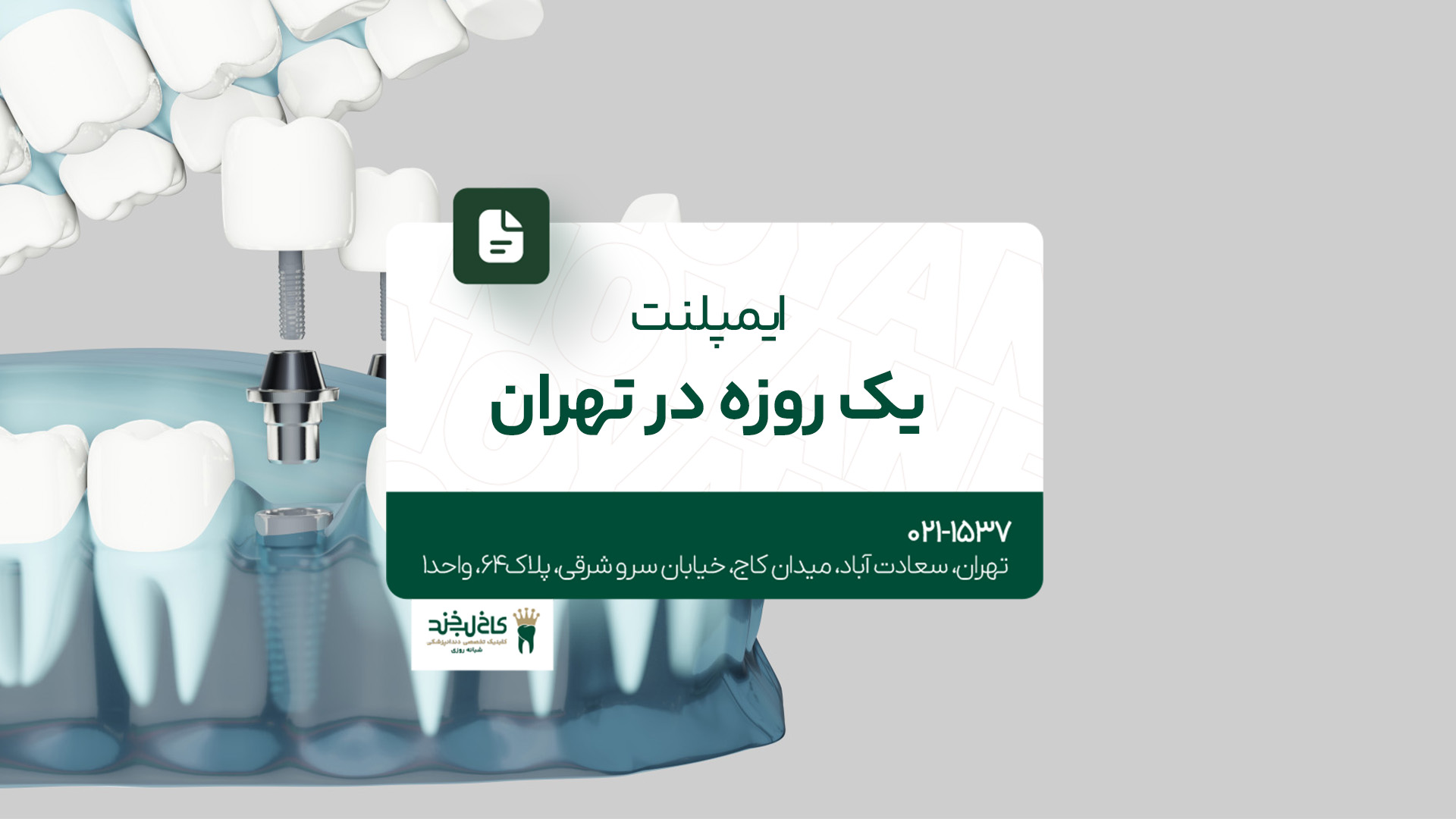 ایمپلنت یک روزه در تهران 
