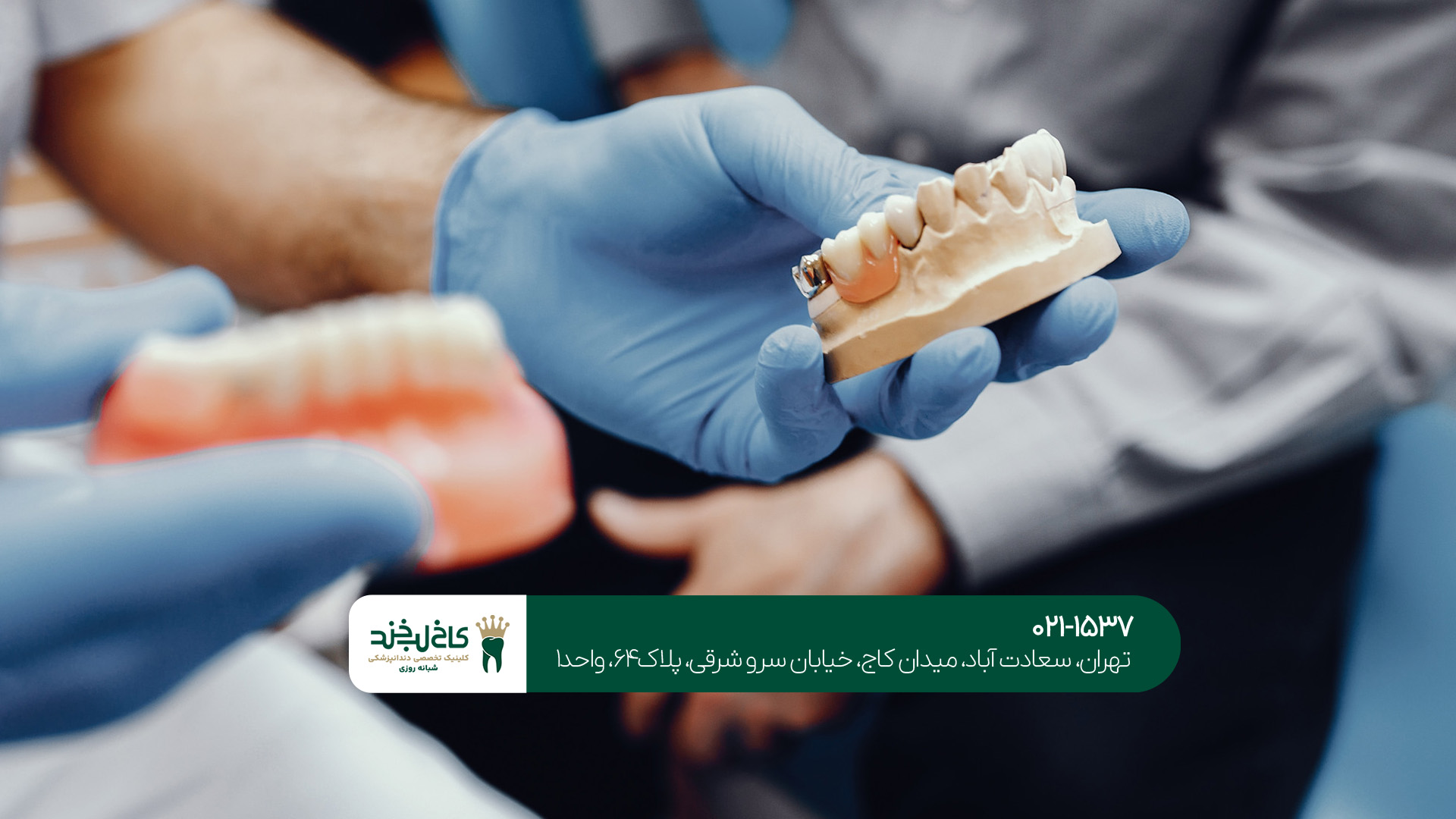 ایمپلنت یا دندان مصنوعی