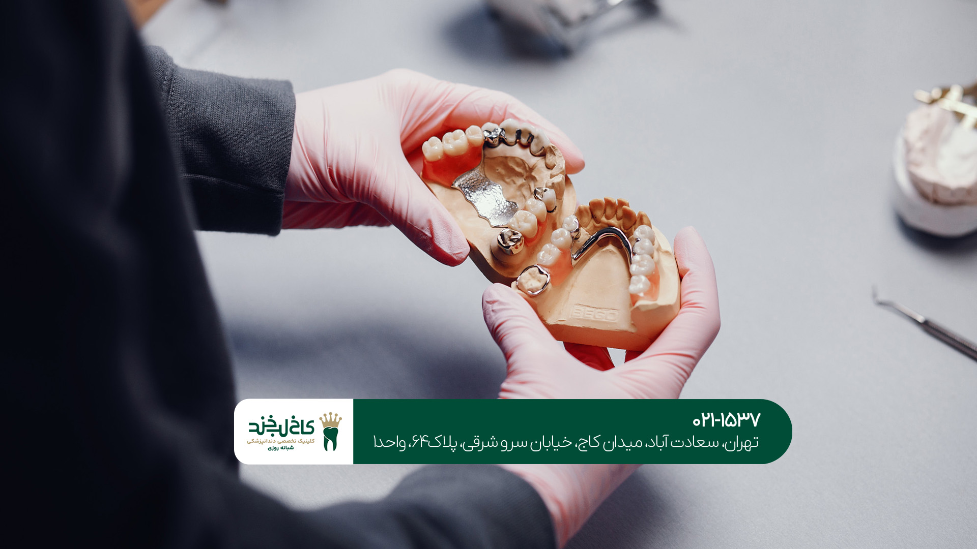 ایمپلنت یا دندان مصنوعی