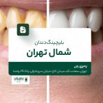 بلیچینگ دندان در شمال تهران