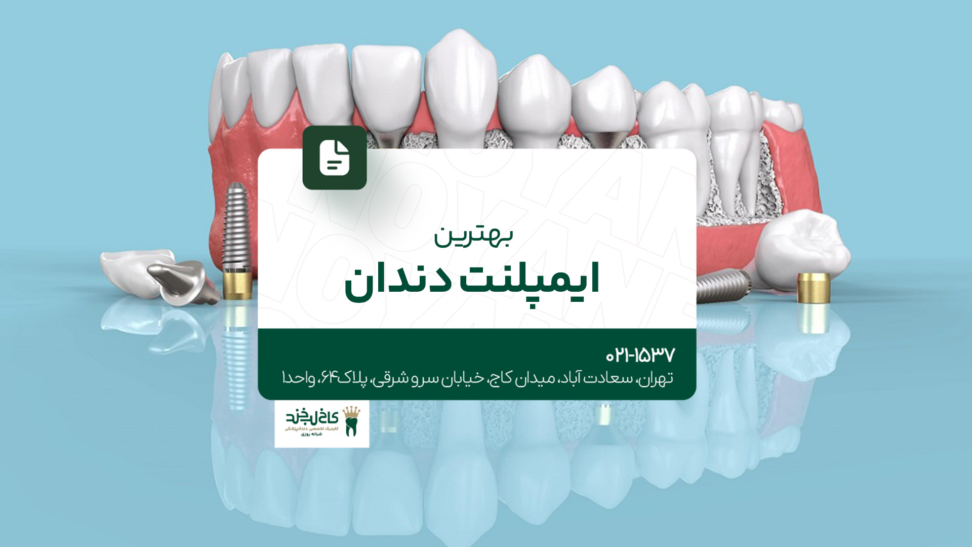 بهترین ایمپلنت دندان در تهران
