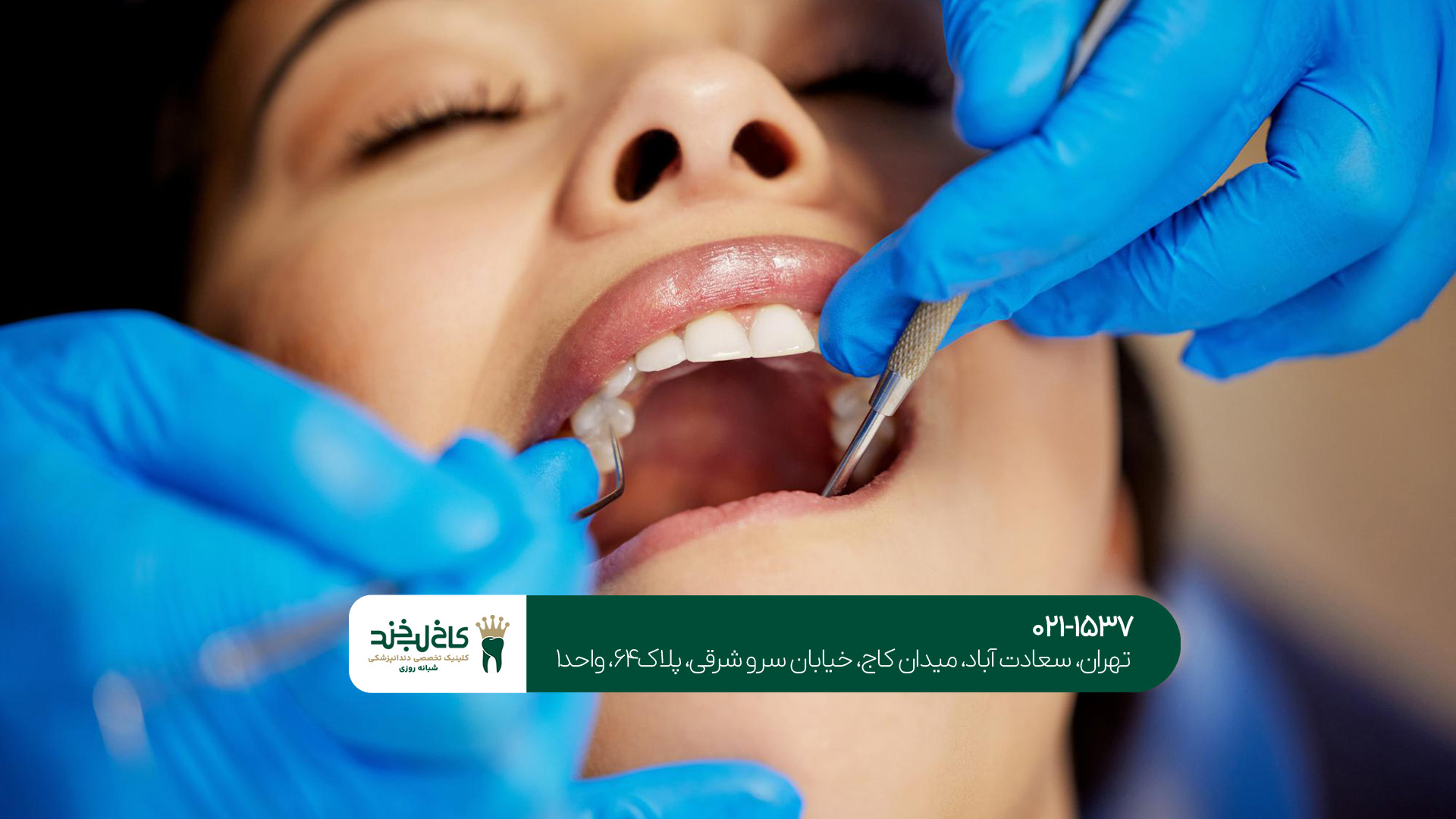 دندانپزشکی شبانه روزی در صادقیه