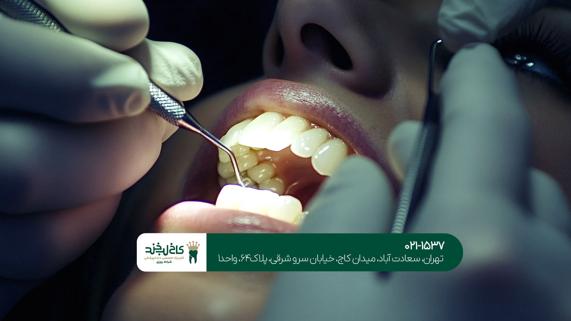 چرا بعضی وقت‌ها باید به طور مجدد عصب کشی انجام دهیم؟!