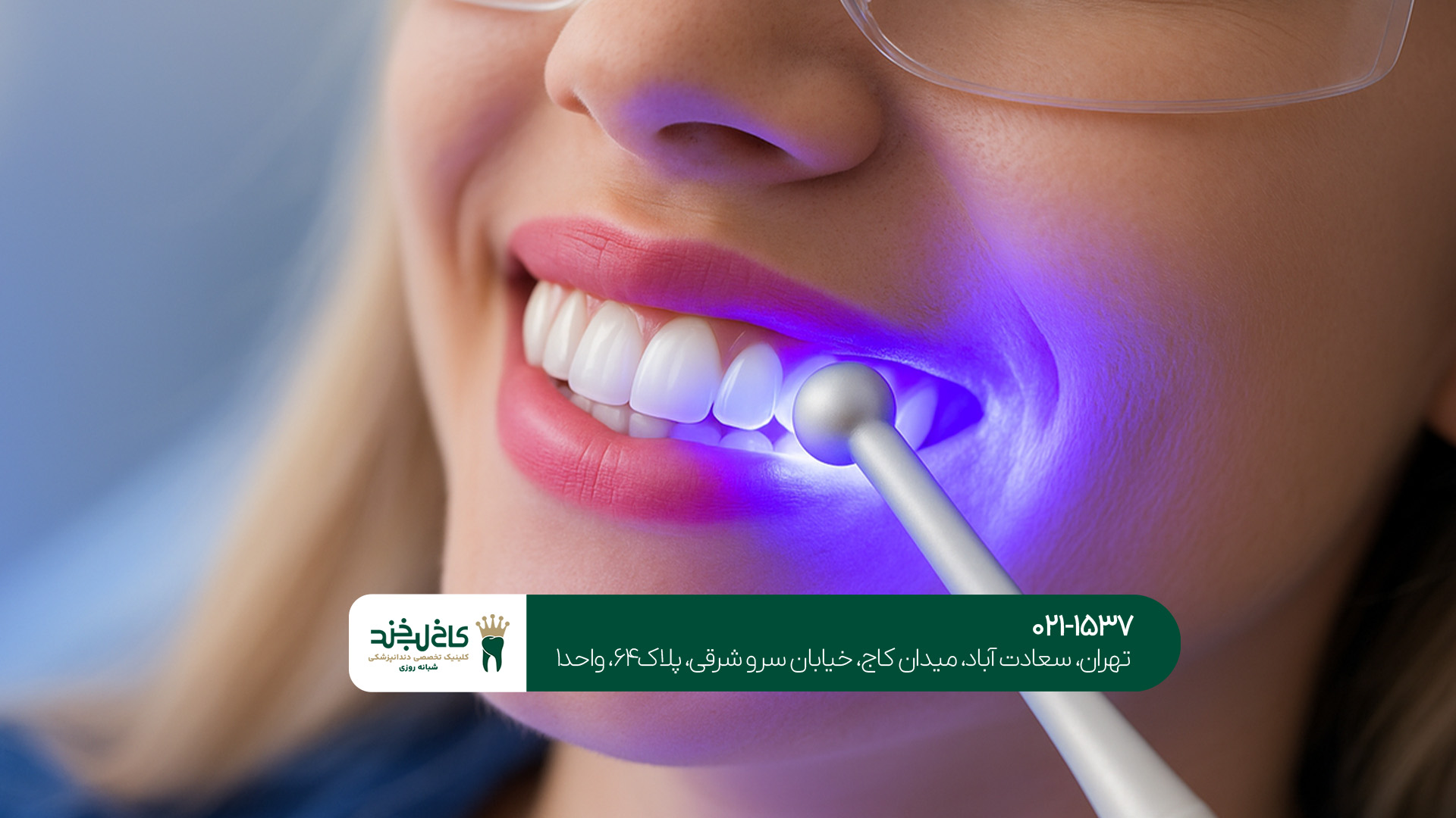 کامپوزیت یونیورسال