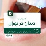 کامپوزیت دندان در تهران
