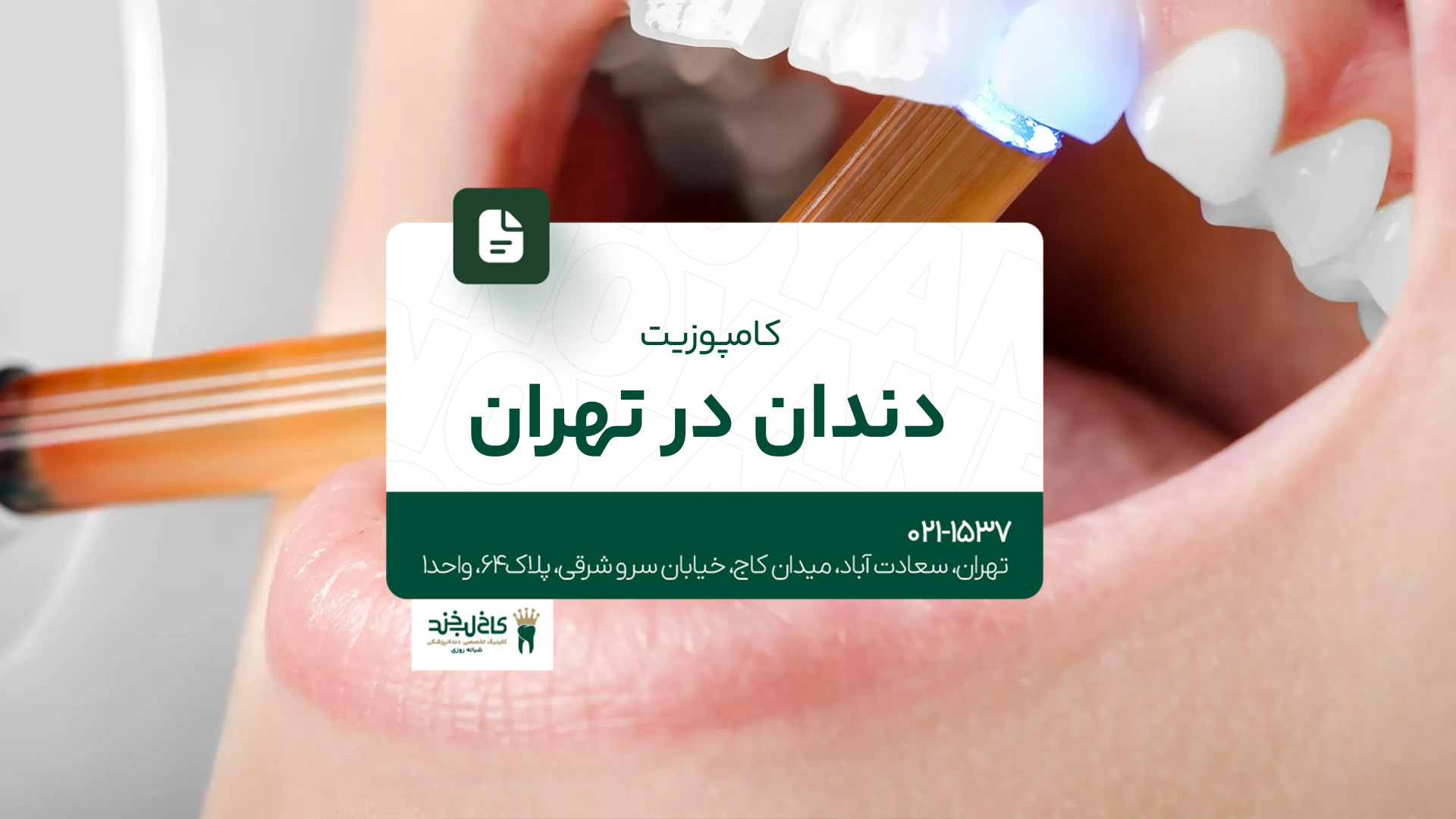 کامپوزیت دندان در تهران 