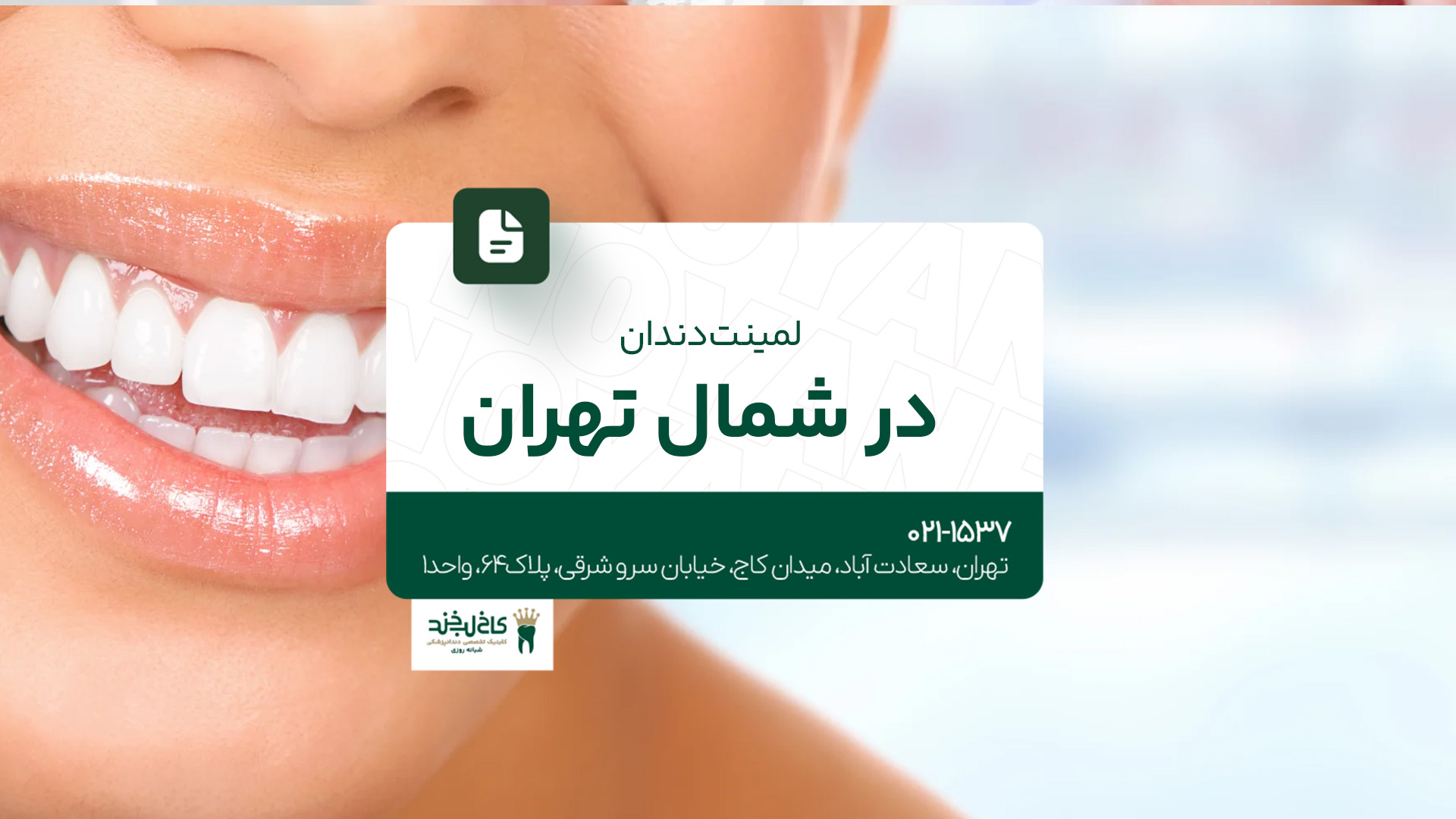 لمینت دندان در شمال تهران 