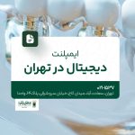 ایمپلنت دیجیتال در تهران