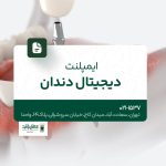 ایمپلنت دیجیتال دندان