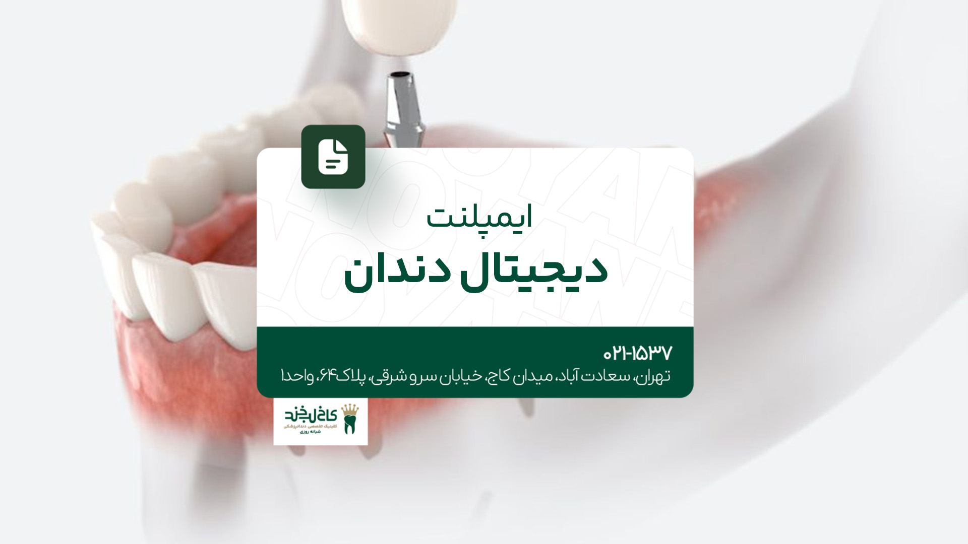 ایمپلنت دیجیتال دندان