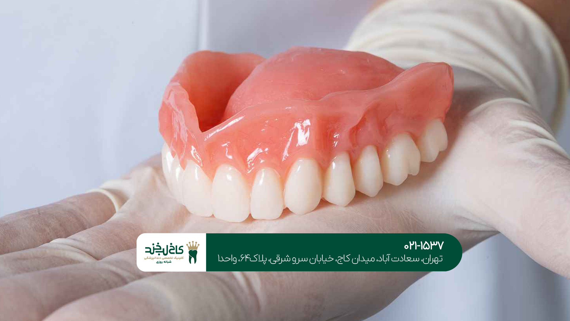 مراقبت از ایمپلنت