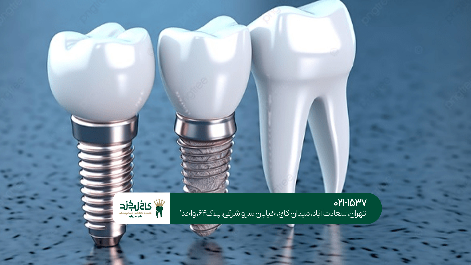 دندان مصنوعی چیست