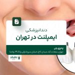 دندانپزشکی ایمپلنت در تهران