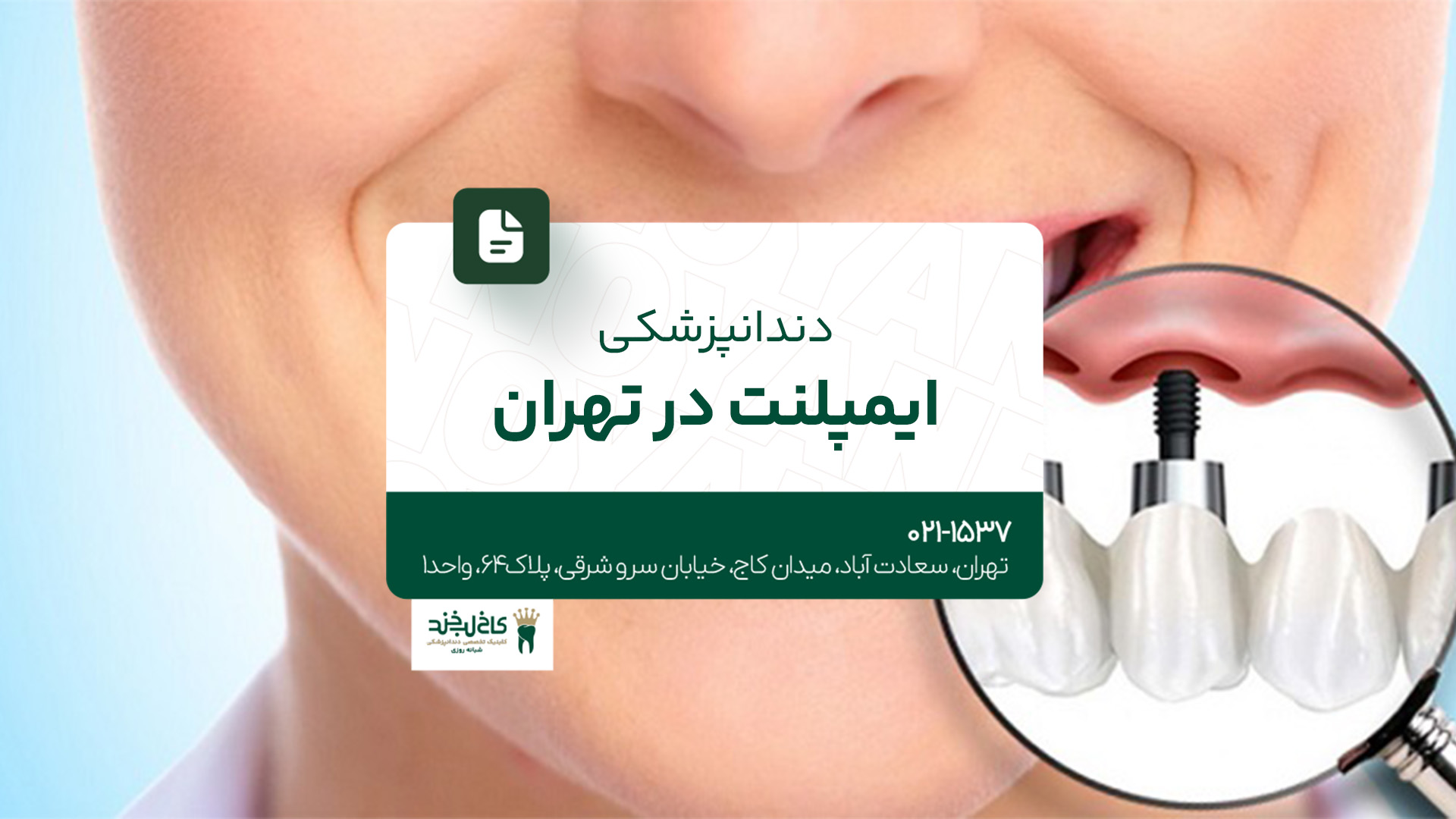 دندانپزشکی ایمپلنت در تهران