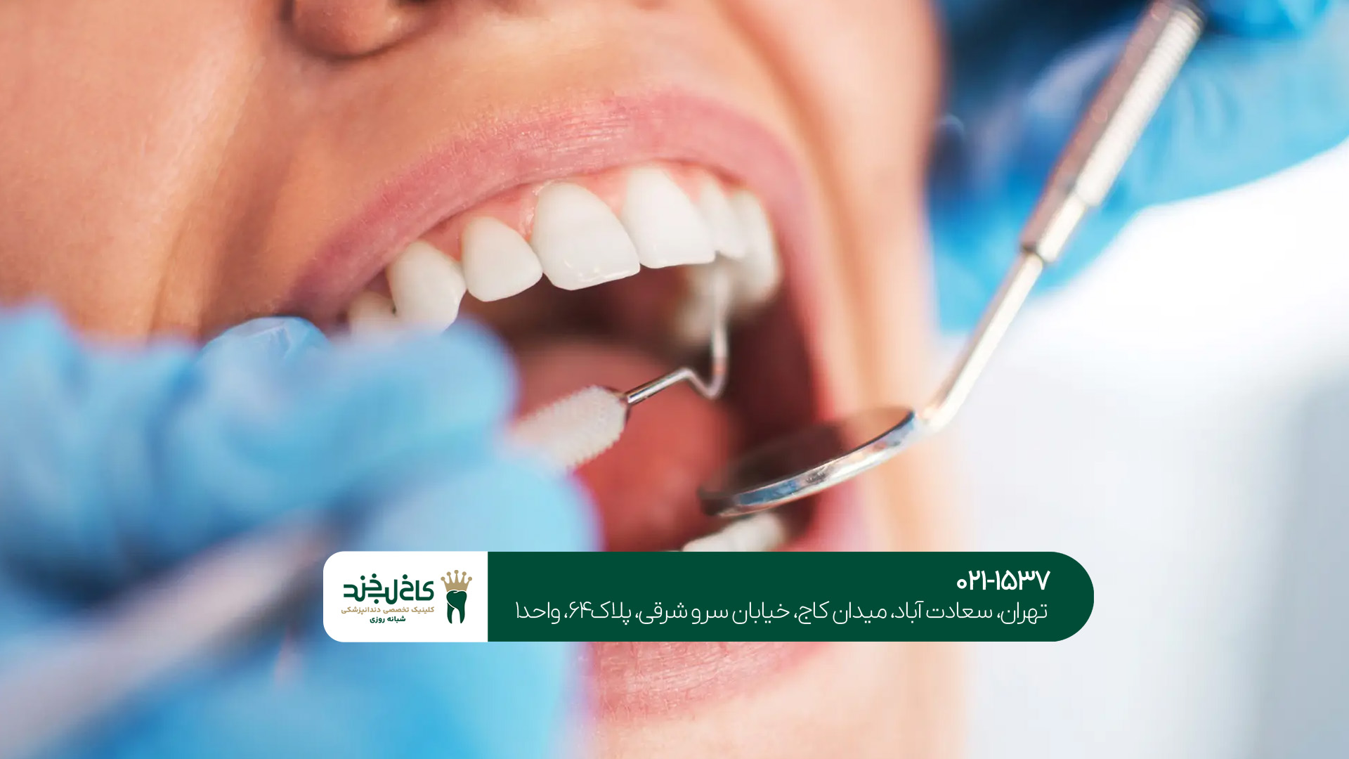 مشاوره دندانپزشکی تهران به‌صورت آنلاین