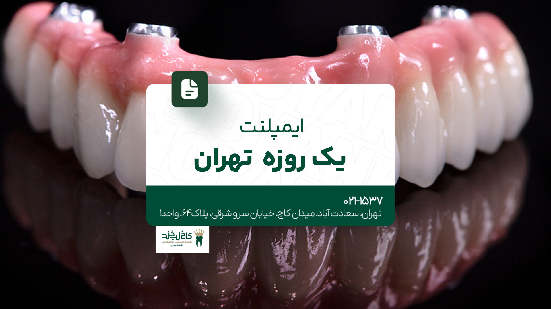 ایمپلنت یکروزه تهران ایمپلنت یکروزه تهران