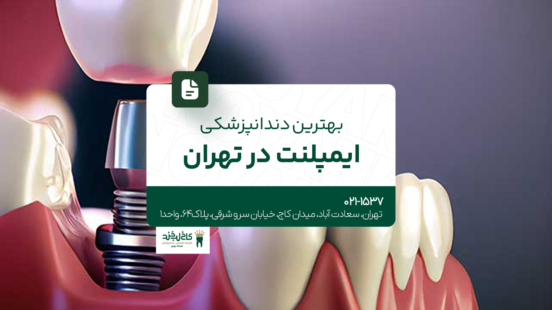 بهترین دندانپزشکی ایمپلنت در تهران