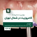 بهترین دندانپزشک کامپوزیت در شمال تهران