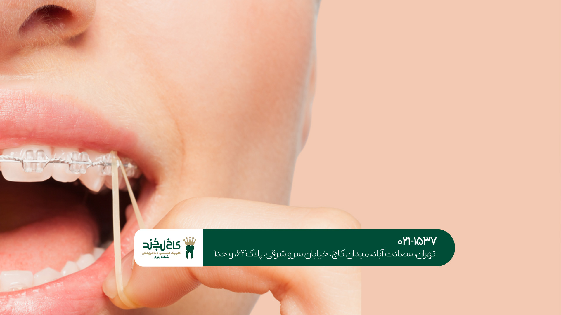 بهترین متخصص ارتودنسی شمال تهران بهترین متخصص ارتودنسی شمال تهران