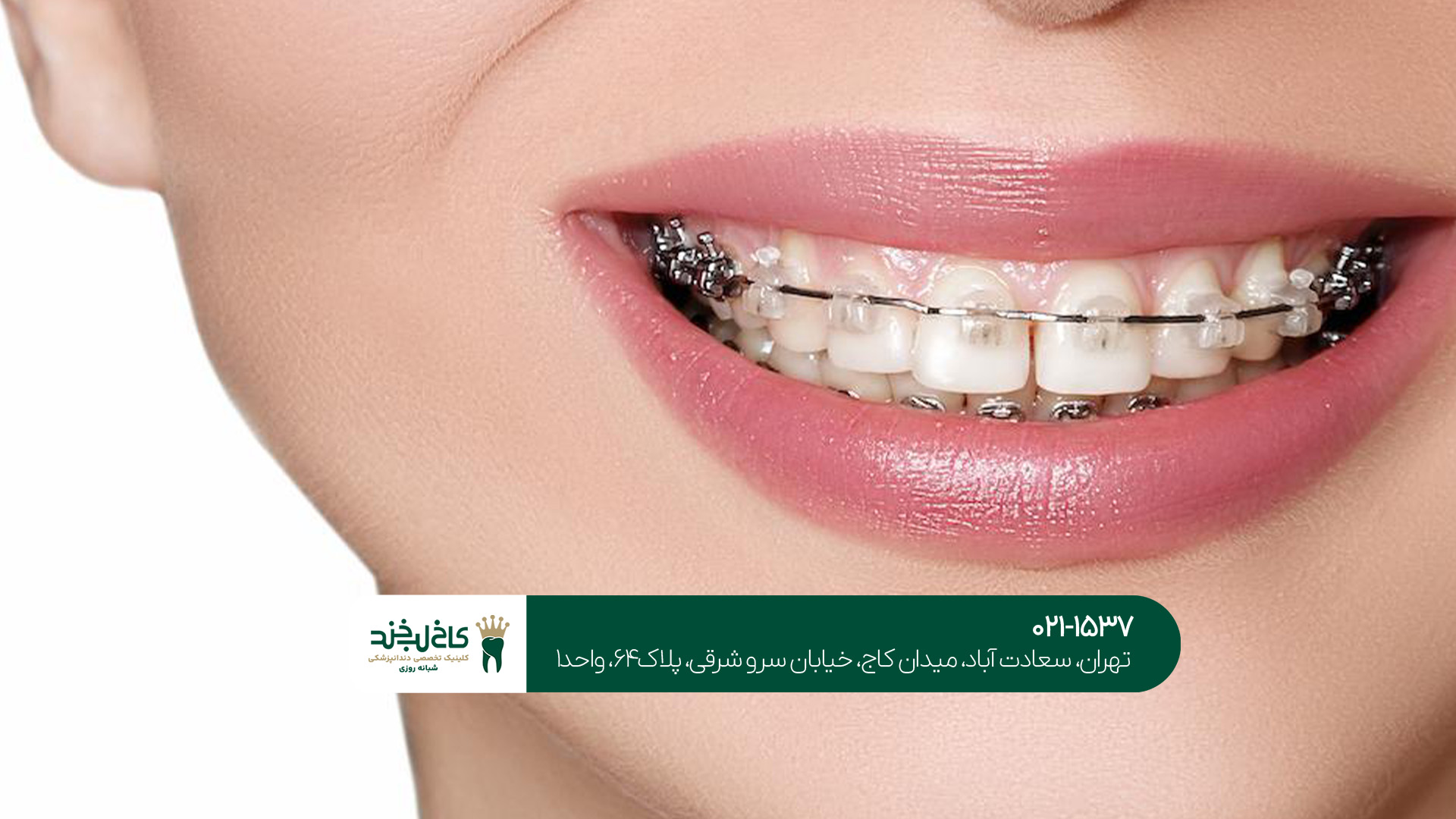 بهترین متخصص ارتودنسی شمال تهران بهترین متخصص ارتودنسی شمال تهران