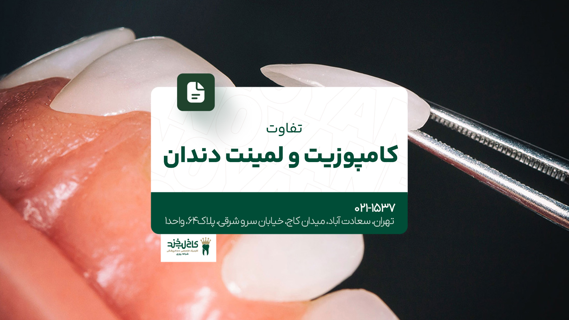 تفاوت کامپوزیت و لمینت دندان تفاوت کامپوزیت و لمینت دندان