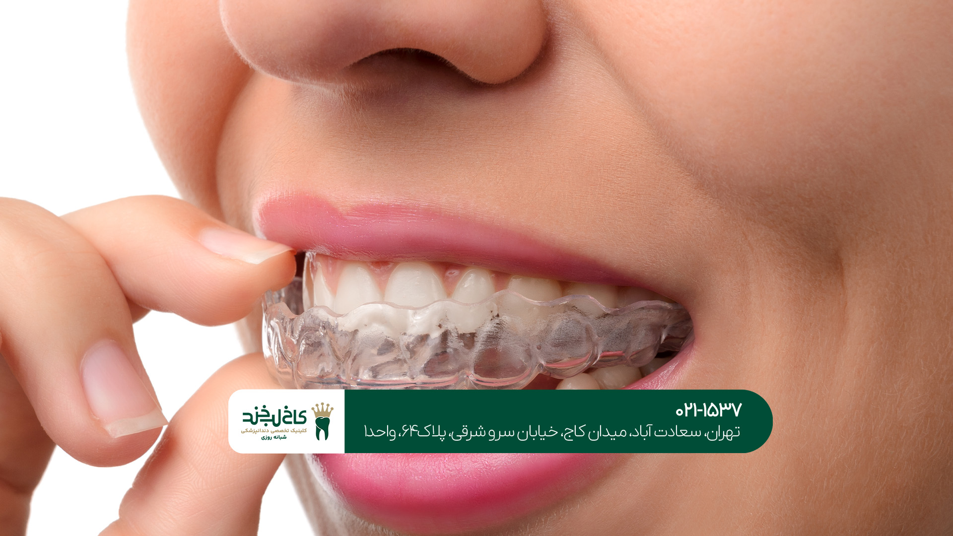 خدمات تخصصی دندان در تهران خدمات تخصصی دندان در تهران