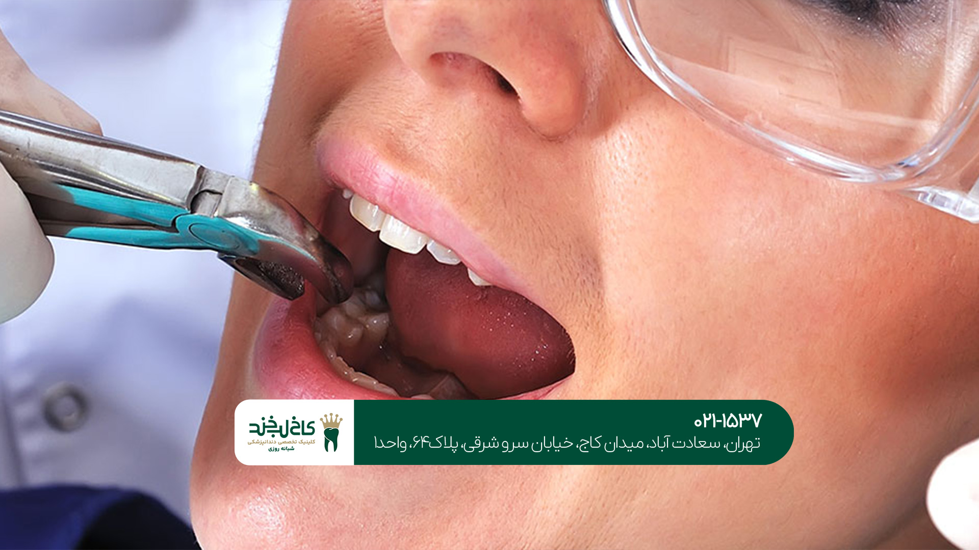 خدمات تخصصی دندان در تهران خدمات تخصصی دندان در تهران